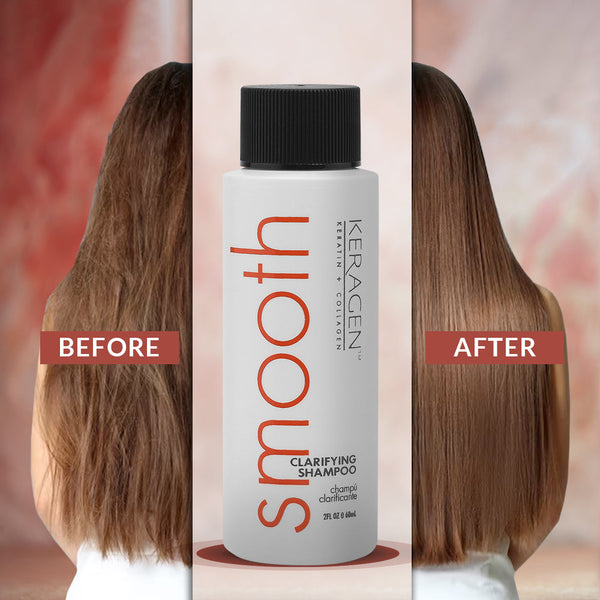 KERAGEN - Clarifying Shampoo with Keratin and Collagen - Deep Cleansing, Purifying, Refresh and Reset Damaged, Color-Treated Hair, Removes Buildup and Residue from Scalp - For All Hair Types - Beauty Market Online